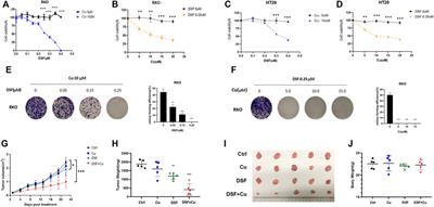 The Disulfiram/Copper Complex Induces Autophagic Cell Death in Colorectal Cancer by Targeting ULK1